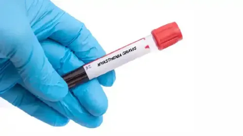 What is the Best Treatment for Myasthenia Gravis?